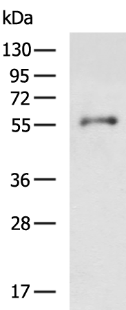 Rabbit Polyclonal Antibody to AMIGO2