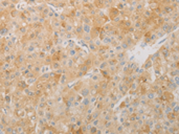 Rabbit Polyclonal Antibody to TLE5