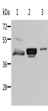 Rabbit Polyclonal Antibody to ACY1