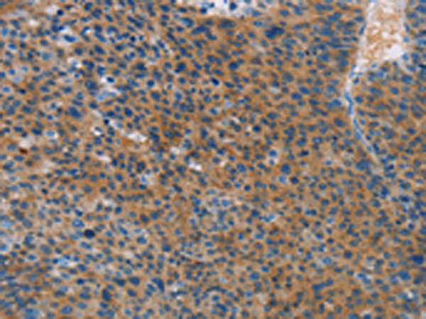 Rabbit Polyclonal Antibody to STAMBP