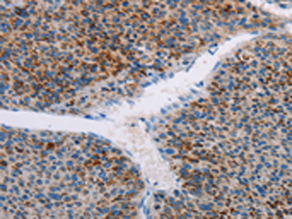 Rabbit Polyclonal Antibody to AMOTL2