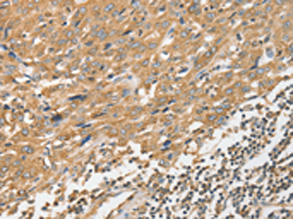 Rabbit Polyclonal Antibody to ANGPTL7