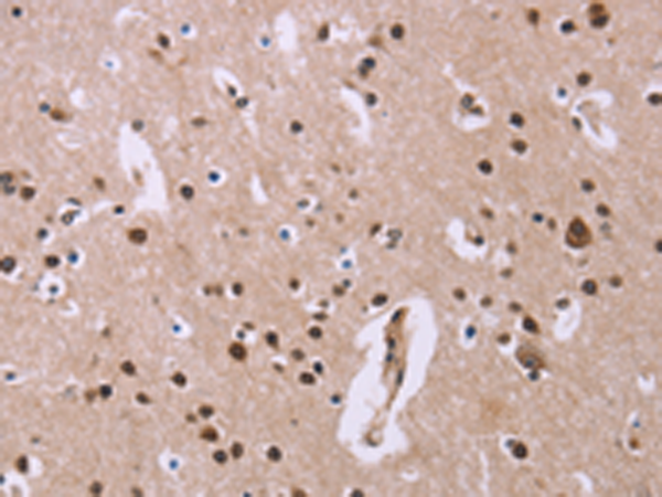 Rabbit Polyclonal Antibody to ANLN