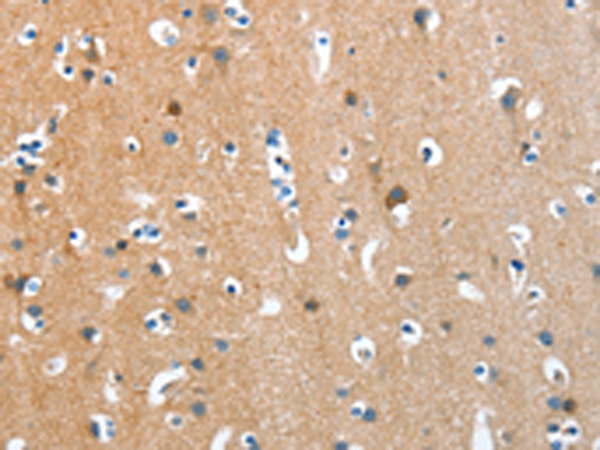 Rabbit Polyclonal Antibody to ANKMY1