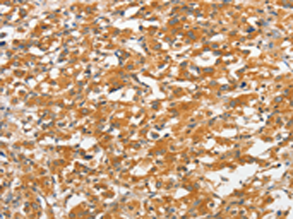 Rabbit Polyclonal Antibody to ANKMY2