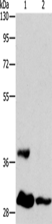 Rabbit Polyclonal Antibody to ANKRD54