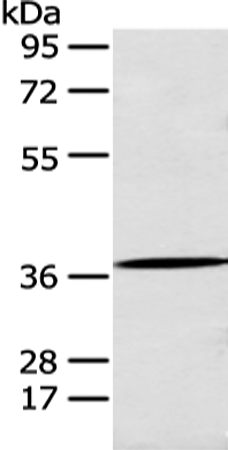 Rabbit Polyclonal Antibody to ANXA10