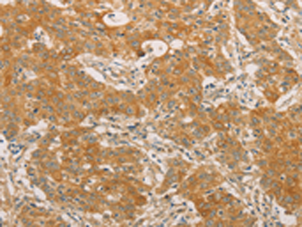 Rabbit Polyclonal Antibody to SNAP91