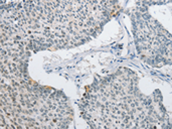Rabbit Polyclonal Antibody to AP2M1