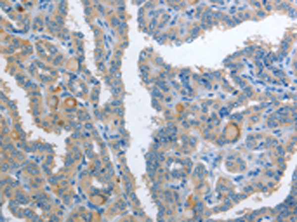 Rabbit Polyclonal Antibody to AP2S1