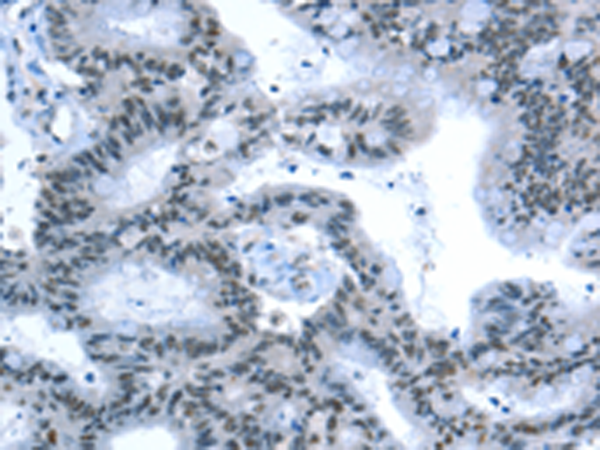 Rabbit Polyclonal Antibody to RPL15