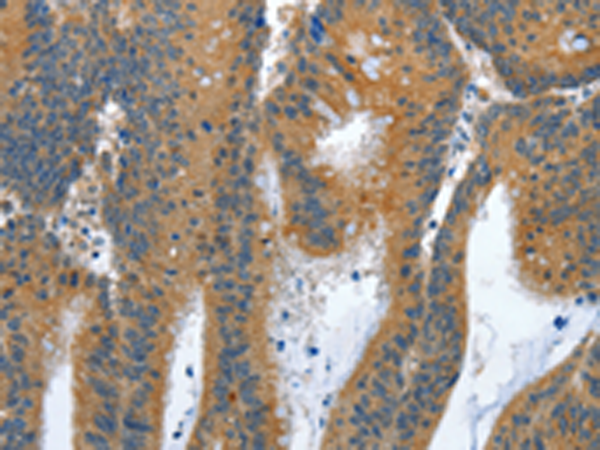 Rabbit Polyclonal Antibody to ANAPC10