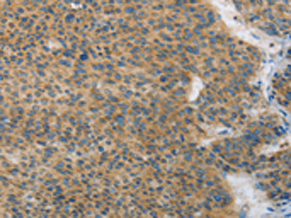 Rabbit Polyclonal Antibody to ANAPC13