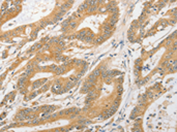 Rabbit Polyclonal Antibody to ATG5