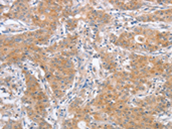 Rabbit Polyclonal Antibody to ATG12