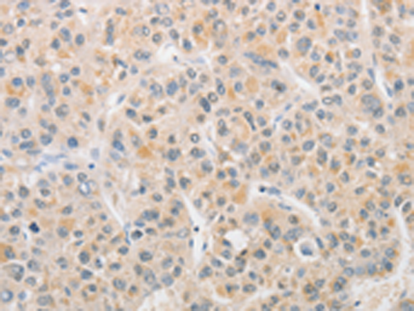 Rabbit Polyclonal Antibody to APLF