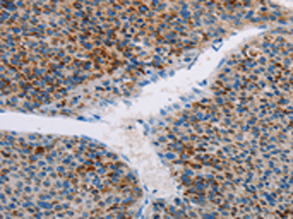 Rabbit Polyclonal Antibody to APOBEC4