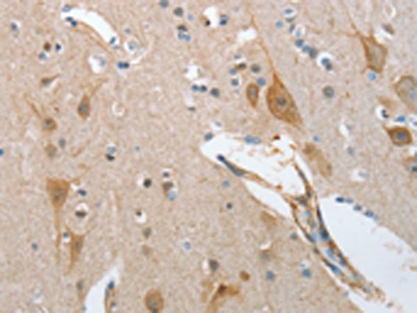 Rabbit Polyclonal Antibody to NOL3