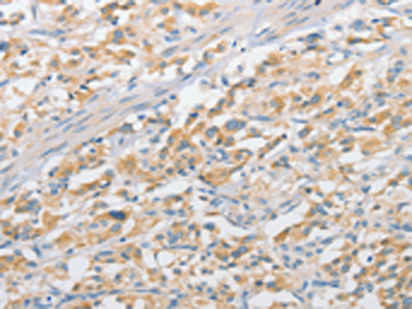 Rabbit Polyclonal Antibody to APPBP2