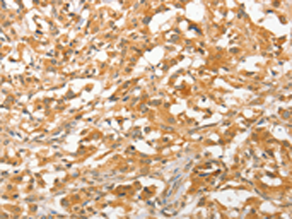 Rabbit Polyclonal Antibody to APTX