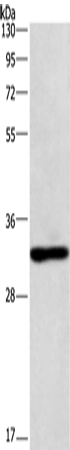 Rabbit Polyclonal Antibody to NAPSA