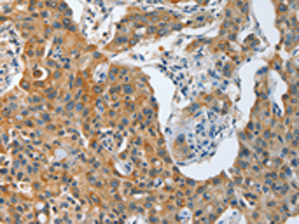 Rabbit Polyclonal Antibody to TNFSF13
