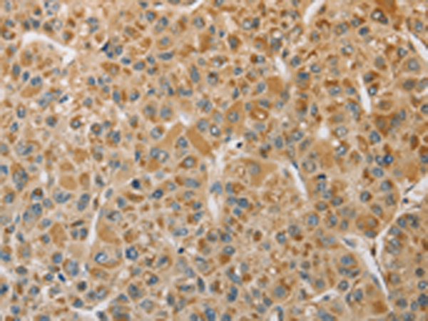 Rabbit Polyclonal Antibody to MIP