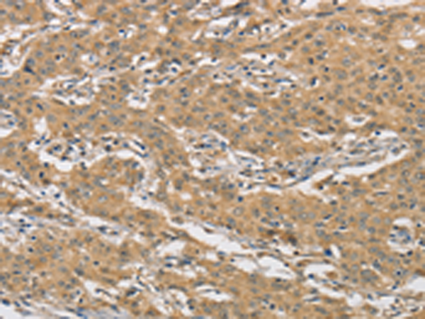 Rabbit Polyclonal Antibody to AMZ2
