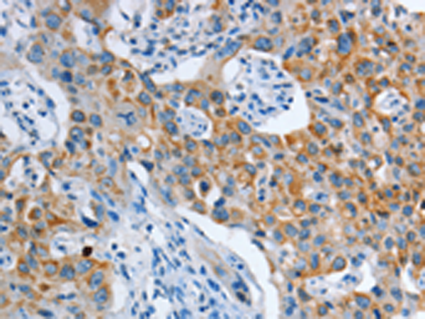 Rabbit Polyclonal Antibody to ASL