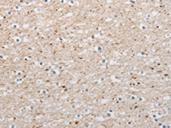 Rabbit Polyclonal Antibody to ARHGAP1