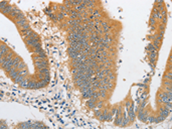 Rabbit Polyclonal Antibody to ARHGAP5