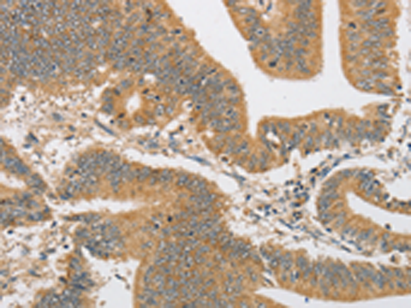 Rabbit Polyclonal Antibody to ARHGAP15