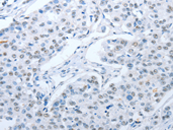 Rabbit Polyclonal Antibody to ARHGEF2