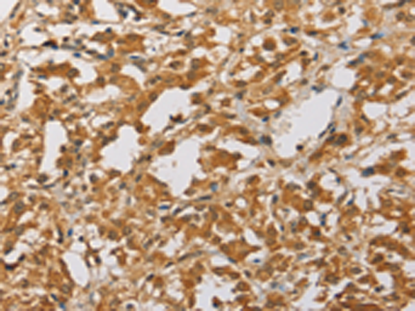 Rabbit Polyclonal Antibody to ARHGEF5