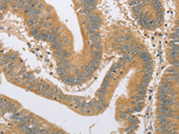 Rabbit Polyclonal Antibody to ARHGEF1