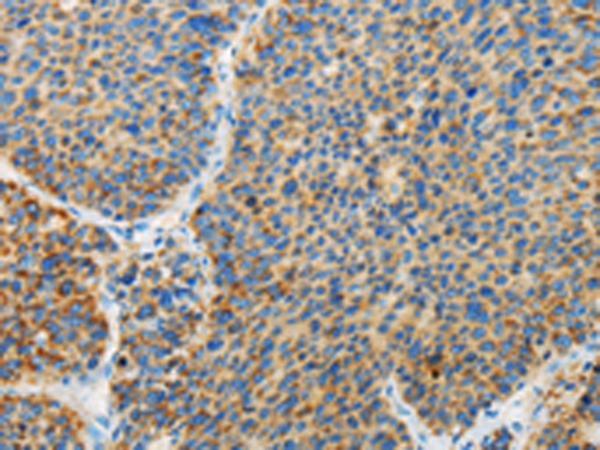 Rabbit Polyclonal Antibody to ARHGEF3