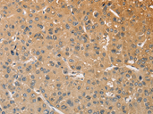 Rabbit Polyclonal Antibody to WNT11