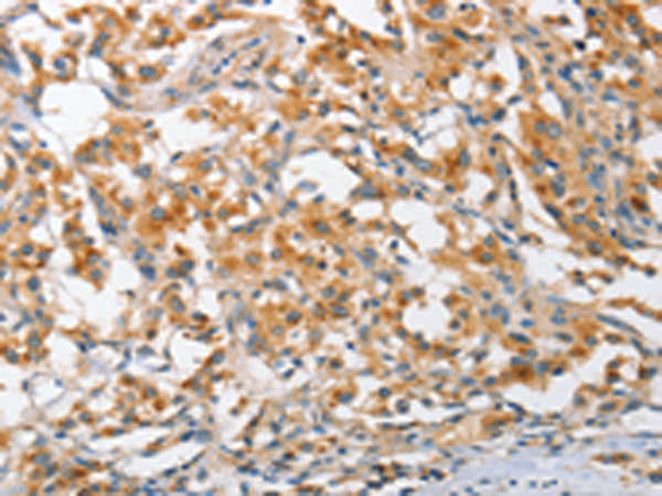 Rabbit Polyclonal Antibody to ARL8A
