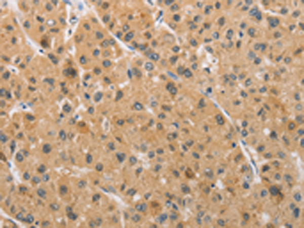 Rabbit Polyclonal Antibody to ARMCX1
