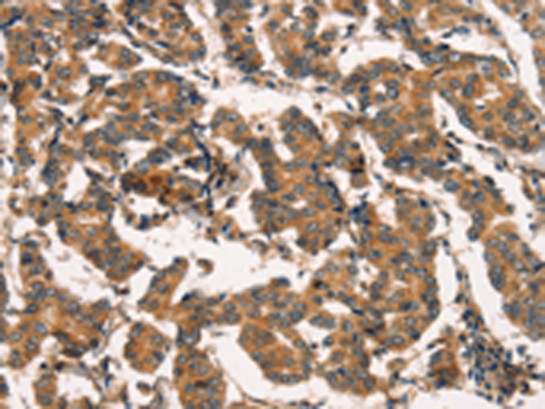 Rabbit Polyclonal Antibody to ARL6IP1