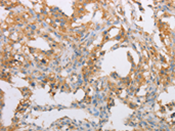 Rabbit Polyclonal Antibody to ACTR2