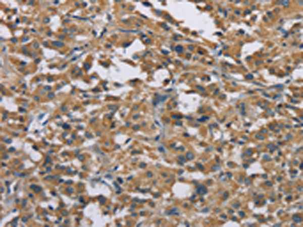 Rabbit Polyclonal Antibody to GAB1