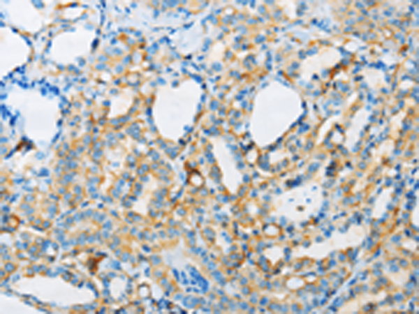 Rabbit Polyclonal Antibody to ARSA