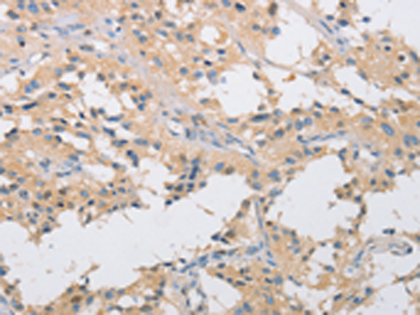 Rabbit Polyclonal Antibody to IKBKG