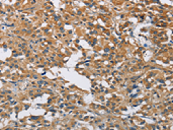 Rabbit Polyclonal Antibody to DNMT3A
