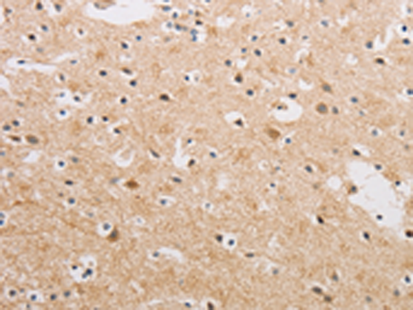 Rabbit Polyclonal Antibody to KAT5
