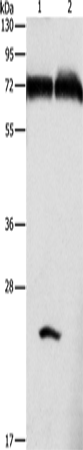 Rabbit Polyclonal Antibody to GDPD5