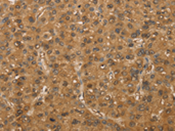 Rabbit Polyclonal Antibody to SETD2