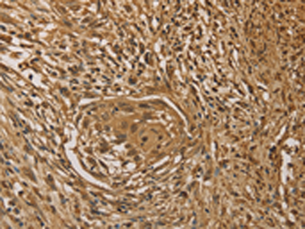 Rabbit Polyclonal Antibody to PRDM14