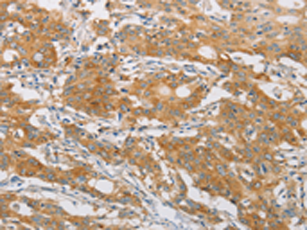Rabbit Polyclonal Antibody to FARSB